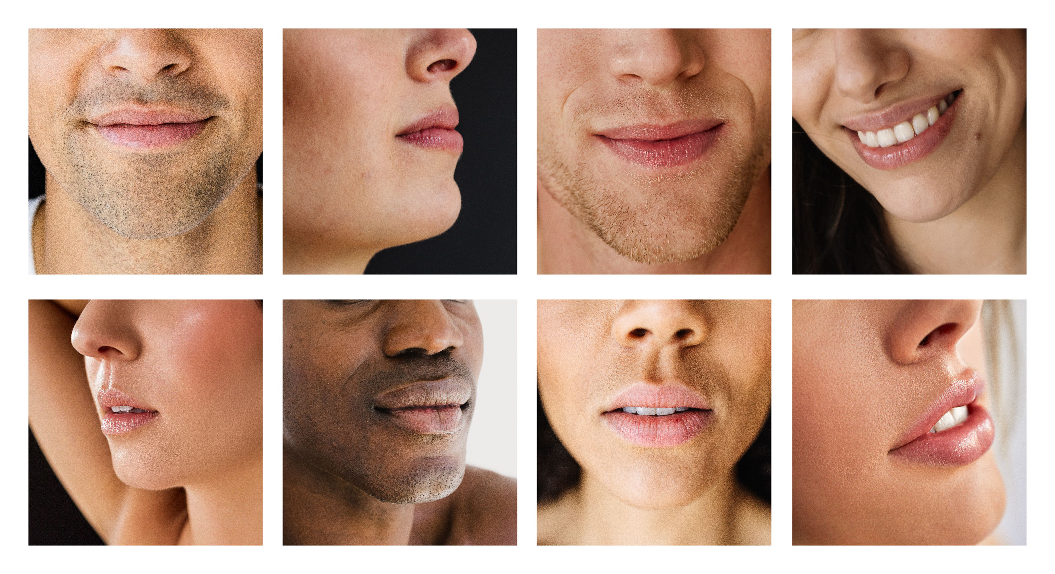 Lip Fillers Sisu Clinics Nationwide